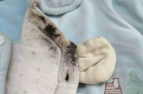 长霉点的衣服怎么洗