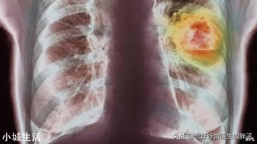 一天一包烟和三天一包烟，哪个伤害更大？人体一天能承受几支烟？