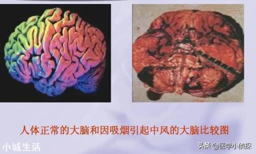 一天一包烟和三天一包烟，哪个伤害更大？人体一天能承受几支烟？