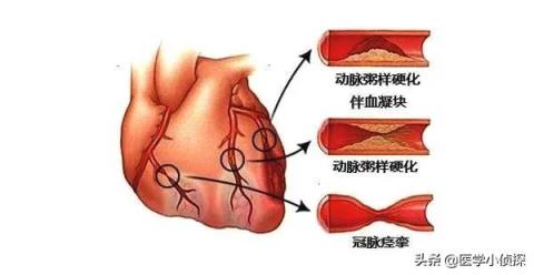 一天一包烟和三天一包烟，哪个伤害更大？人体一天能承受几支烟？