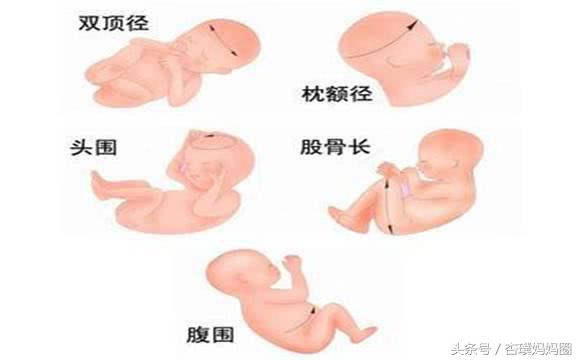 14周头大腿短是男孩是真的吗