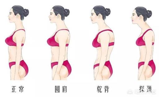 怎样改善脖子前伸的现象？