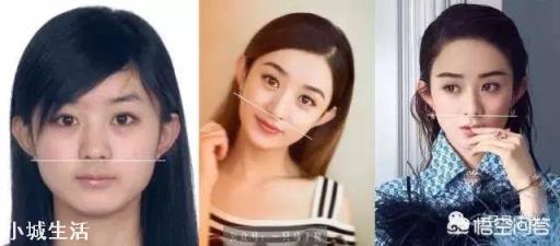 怎样改善脖子前伸的现象？