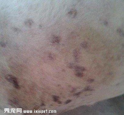 是什么黑色棘皮癥？黑色棘皮癥的癥狀和治療方法