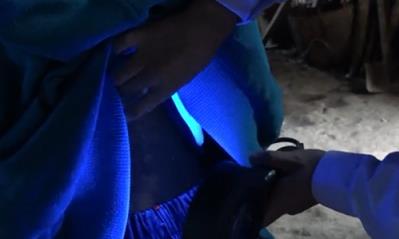我们为爱行动 长沙华山白癜风医院好不好？祛白公益行