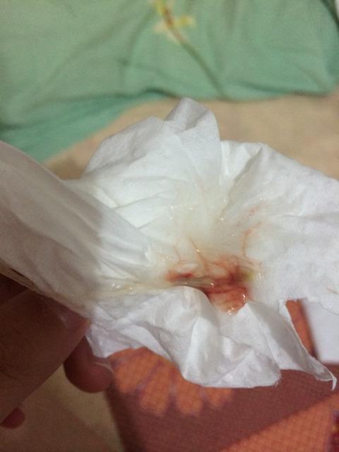 貓咪喉嚨那里摸著會有凸起嗎 貓咪脖子里面摸著像瘤