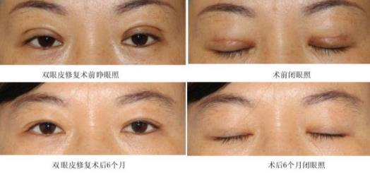 整形行业的“玉雕工匠” 深圳军科医院刘月更手术安全吗
