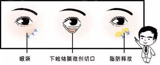 四川眼部整形知名医生 眼综合都包括哪些项目？虞冬梅