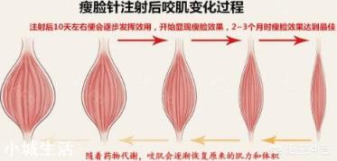 脸大该怎么瘦脸才好呢?