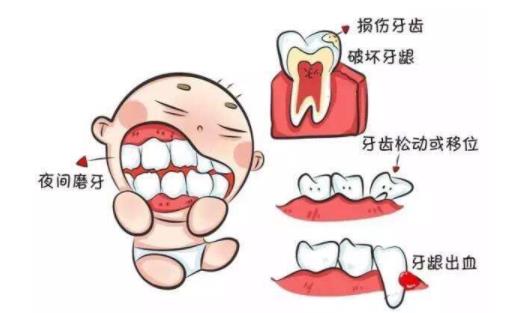 宝宝磨牙的食疗方 宝宝磨牙是因为肚里有虫吗