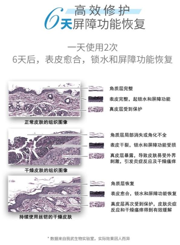 丝铠丝素蛋白保湿霜，拯救秋冬季干燥瘙痒的皮肤！