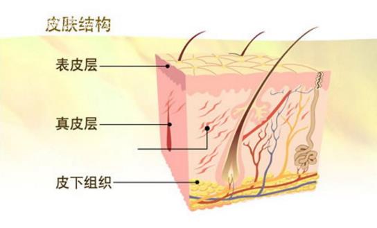 脸上有红血丝怎么办，换季敏感肌红血丝加重的修复办法