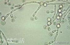 一个想法，也许病毒本身也是智能生物。而且智慧的层次更高阶，它们本就是这个地球的统治者。有这种可能吗？