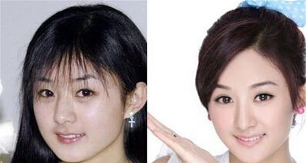 明星减肥方法，你值得拥有