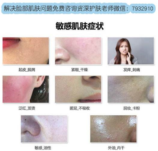 脸过敏痒怎么处理？秋冬季脸过敏你该这么做！