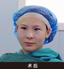 深圳美莱眼整形“双杰”亮相2019中国眼整形高峰论坛