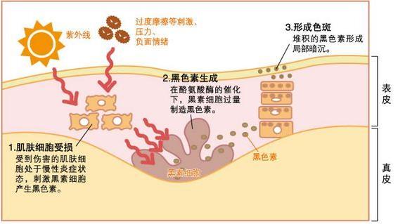 皮肤晒后敏感怎么办?重庆玛恩皮肤医院建议您