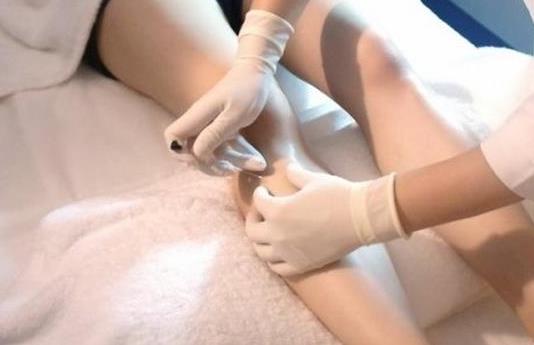 埋线减肥会留疤痕吗？埋线减肥一个疗程要做几次？