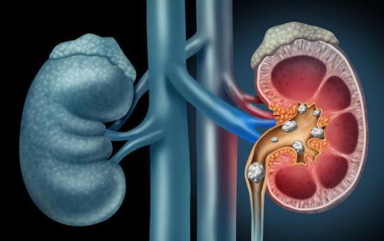 长期吃太咸会导致糖尿病吗？长期吃太咸有哪些危害？
