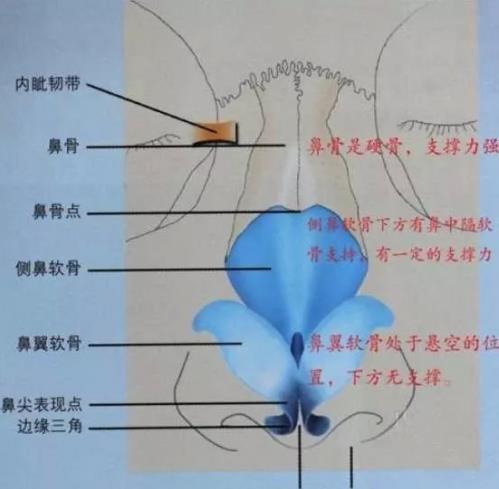 /玻尿酸 『山根低』假体