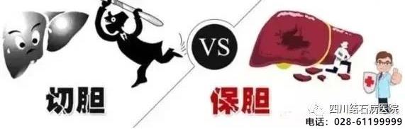 还在犹豫“切胆”还是“保胆”?四川结石病医院告诉你答案!