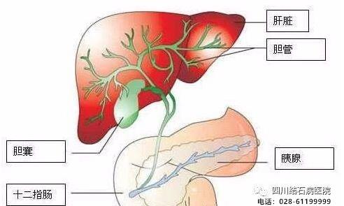 还在犹豫“切胆”还是“保胆”?四川结石病医院告诉你答案!