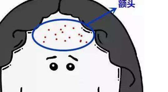 生活中10大影响面相的肌肤问题 女性天性爱美容不得脸上存在瑕疵