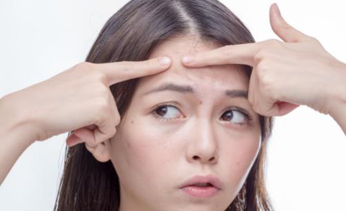 痘痕痘印形成的原因是什么 6大方法抚平脸上痘印