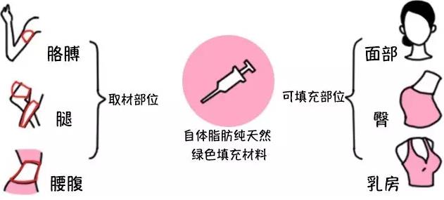 靠谱专家放心美 宁波脂肪填充好不好