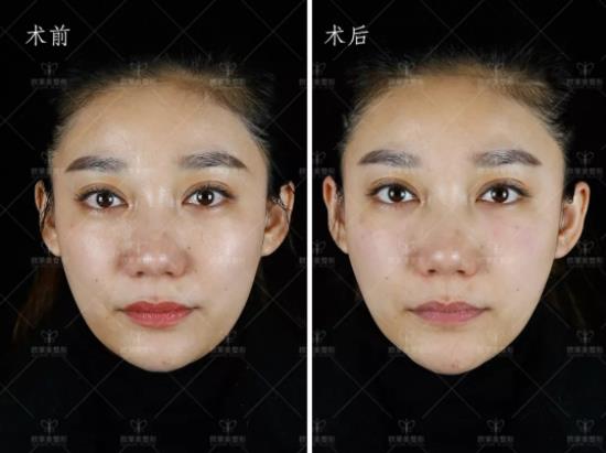 27万人都在看义乌微整形欧莱美现场揭秘重返青春年轻的秘密！