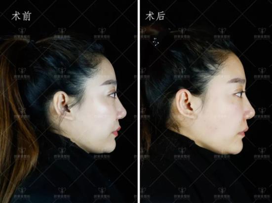 27万人都在看义乌微整形欧莱美现场揭秘重返青春年轻的秘密！