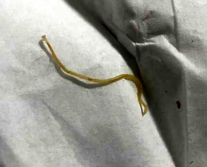 为什么要定期为猫咪驱虫?猫咪驱虫的重要性!