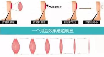 点燃您的靓丽丰采 天津河东美莱医院整形好么