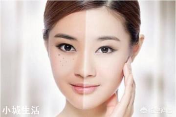哪些因素会导致产生黄褐斑？