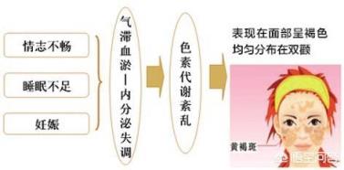 哪些因素会导致产生黄褐斑？
