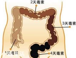 便秘该怎么办？