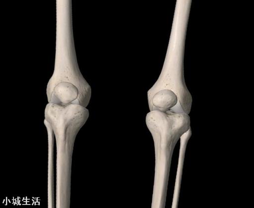 练习太极拳会损伤膝关节吗？