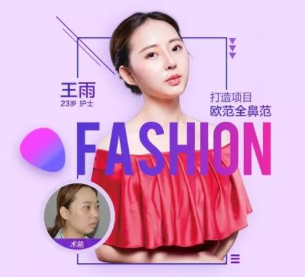 义乌欧莱美鼻整形案例免费招募活动火热进行中!