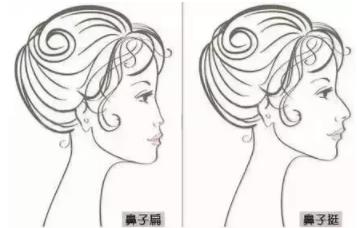 义乌欧莱美鼻整形案例免费招募活动火热进行中!