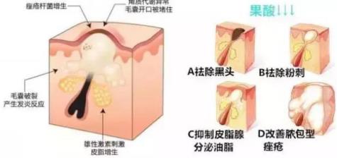 北京伊美尔健翔医院:玻尿酸除皱的价格