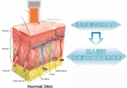 北京伊美尔健翔医院:玻尿酸除皱的价格