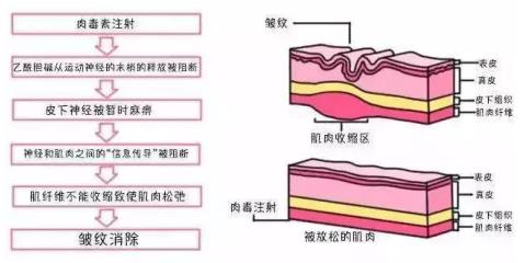 北京伊美尔健翔医院:玻尿酸除皱的价格