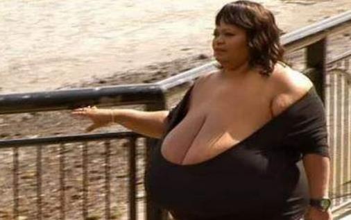 安妮·霍金斯·特纳双乳重达38.5公斤 世界上最大的天然乳房