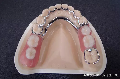 怎么防止牙龈萎缩加重 如何防止牙龈萎缩