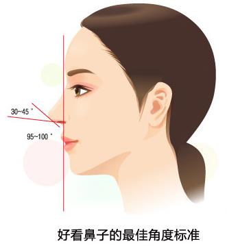 煤医整形王驰主任:并不是什么人都适合鼻综合手术
