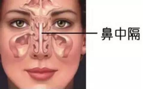 煤医整形王驰主任:并不是什么人都适合鼻综合手术