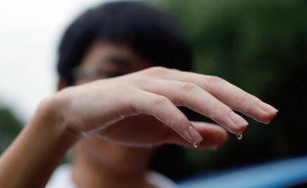 脚消肿最好的偏方大全 如何消肿