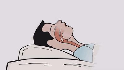 为啥睡觉打鼾光吵别人不吵自己？成都民生耳鼻喉告诉你答案！