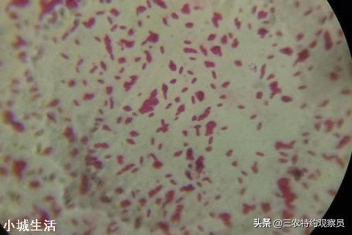 请问，施撒菌肥后土壤一直干旱会失效吗？