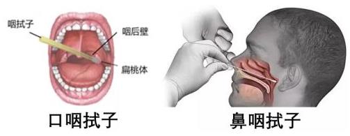 普通人需要做核酸检测吗?咽拭子核酸检测疼不疼?准确率有多高?